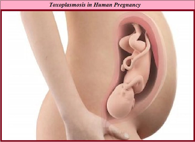 Toxoplasmosis in Human Pregnancy